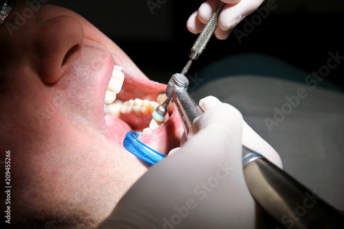 Dental check up. Dental male patient at regular dental check, at dental clinic and office. Man with dental suction tube in mouth. Healthcare and medical. Dentistry and oral hygiene. Dentist Concept.