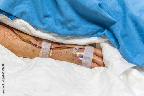 Patient with saline intravenous in the hospital