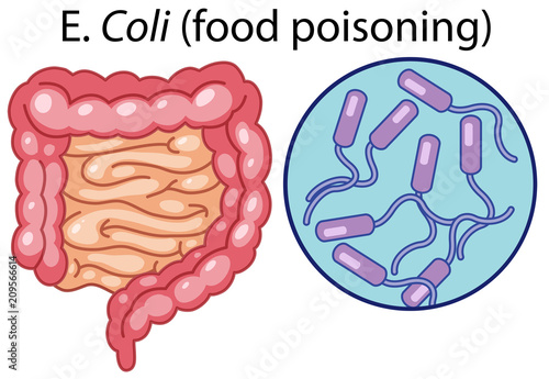 A Vector of E Coli Bacteria