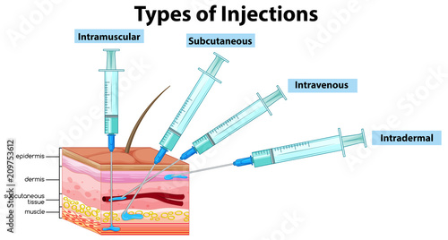 Types of Injections on White Background photo