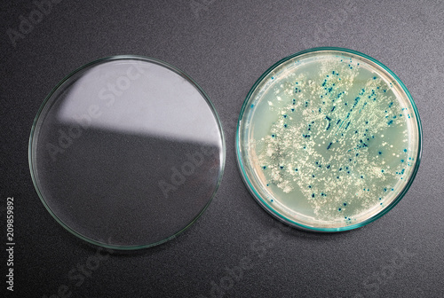 Agar plate with bacterial colonies for plasmid vector cloning on dark background