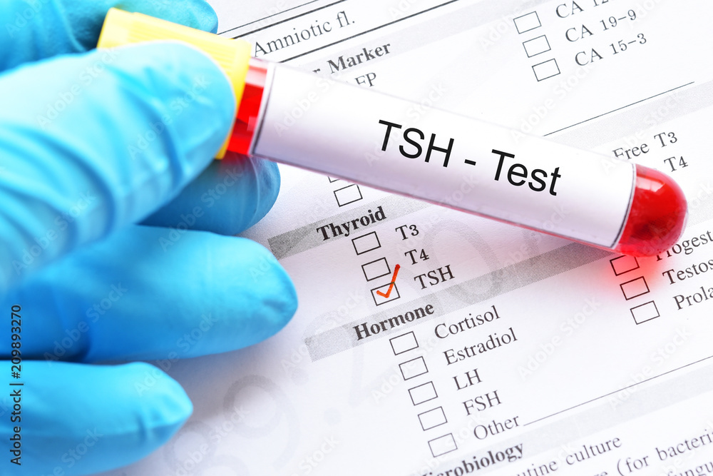 Blood sample tube with laboratory requisition form for thyroid