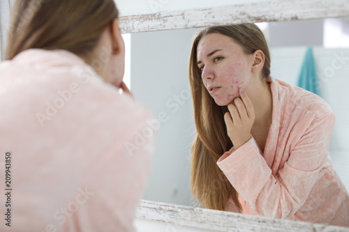Young woman with acne problem near mirror in bathroom photo