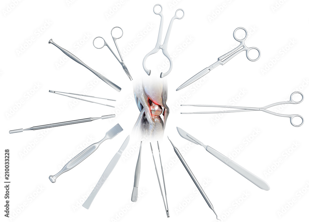 Medical surgical instruments around the human diseased knee joint - scalpel, scissors, forceps, lancet, chisel, knife. Medicine and healthcare concept, isolated on white. 3D illustration Medical surgical instruments around the human diseased knee joint - scalpel, scissors, forceps, lancet, chisel, knife. Medicine and healthcare concept, isolated on white. 3D illustration