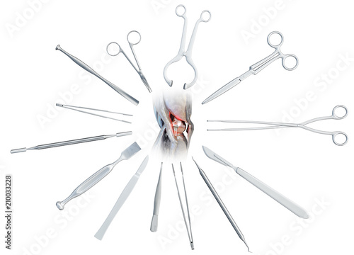 Medical surgical instruments around the human diseased knee joint - scalpel, scissors, forceps, lancet, chisel, knife. Medicine and healthcare concept, isolated on white. 3D illustration 