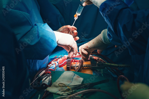 cardiovascular surgery team surgeons in surgery center for interventions with instruments in surgeon operation electrosurgery with thoracotomy microsurgery doing minimal invasive open heart surgery photo