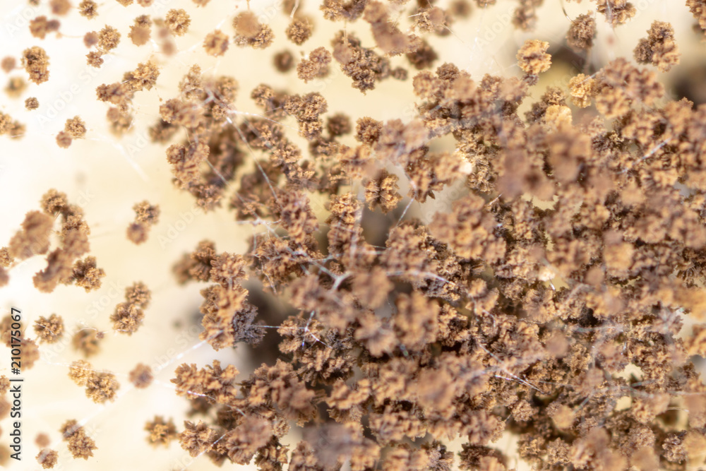 Rhizopus (bread mold) is a genus of common saprophytic fungi,Rhizopus (bread mold) under the microscope. Rhizopus (bread mold) is a genus of common saprophytic fungi,Rhizopus (bread mold) under the microscope.