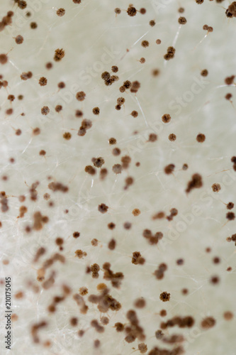 Rhizopus (bread mold) is a genus of common saprophytic fungi,Rhizopus (bread mold) under the microscope.