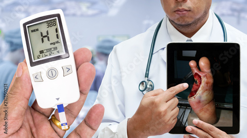 Doctor showing picture of diabetic foot ulcer (wound) on tablet computer in operation room with hand holding blood glucose meter showing High level of blood glucose. photo