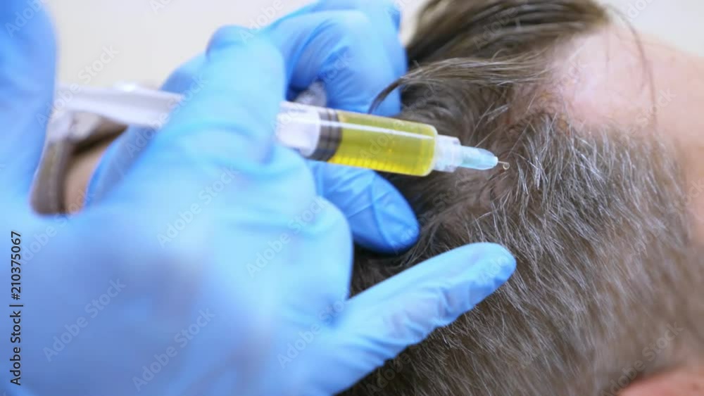 Vidéo Stock The procedure of cosmetology and centrifuge for