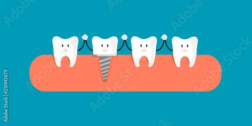 Fun concept with Filling dental implant with crown. 4 happy tooth in cartoon style. Vector illustration design.
