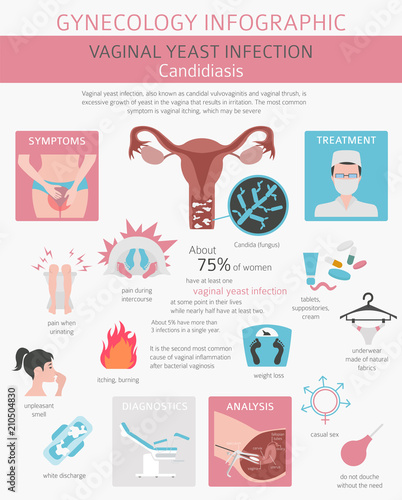 Vaginal yeast infection. Candidiasis. Ginecological medical desease infographic