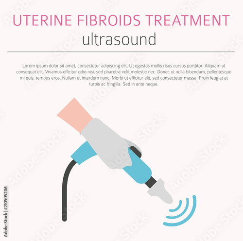 Uterine fibroids. Ginecological medical desease in women infographic