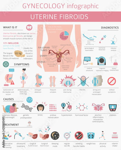 Uterine fibroids. Ginecological medical desease in women infographic