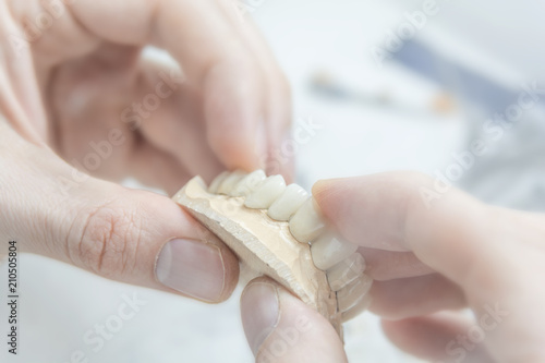 Medical tooth dental technician holding prosthetic in laboratory
