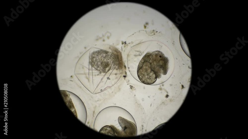 eggs of Planorbis snails with already developed embryo and dead eggs, infected with infusoria etrahymena pyriformis under a microscope photo