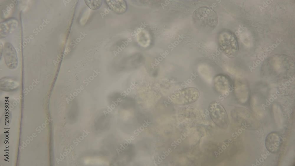 Stockvideon colony of ciliates etrahymena pyriformis eating snail eggs