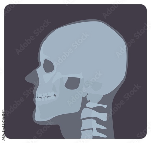 Lateral radiograph of skull. X-ray picture or radiographic image of head, side view. Modern medical radiography and human skeletal system. Monochrome vector illustration in flat cartoon style.
