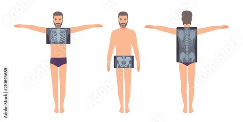 Male patient and his chest, pelvis and back radiograph isolated on white background. Bearded man and X-ray pictures of his skeletal system on monitor. Flat cartoon colorful vector illustration.