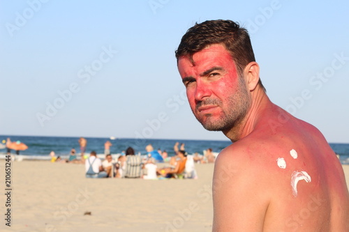 Man suffering the consequences of too much uv light exposure 