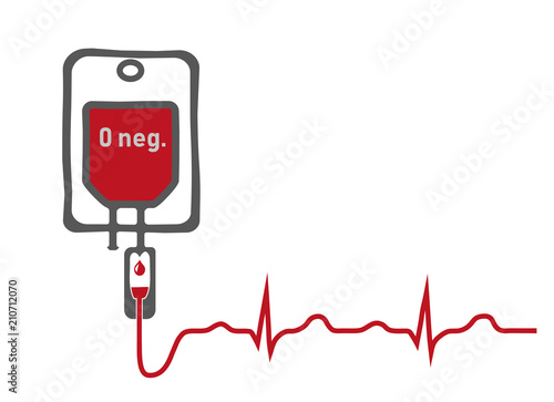 Blutgruppe 0 (Null) negativ - Universalspender: Bluttransfusion mit EKG