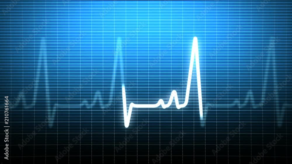 Heartbeat Pulse Monitor Heartbeat Pulse Monitor
