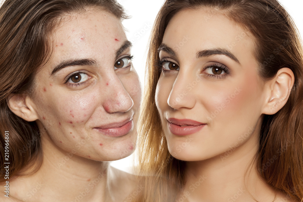 comparition portrait of same woman before and after cosmetic treatment amd makeup on white background comparition portrait of same woman before and after cosmetic treatment amd makeup on white background