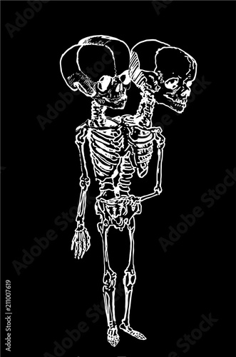Graphical skeleton of siamese twins isolated on black,fashion tattoo sketch,vector illustration of monster