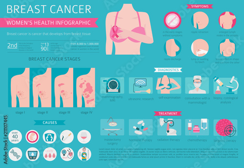 Breast cancer, medical infographic. Diagnostics, symptoms, treatment. Women`s health set