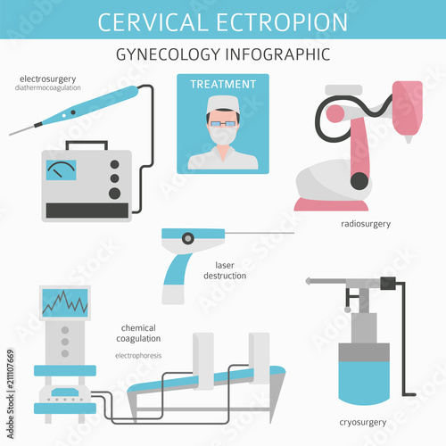 Cervical ectropion. Ginecological medical desease infographic