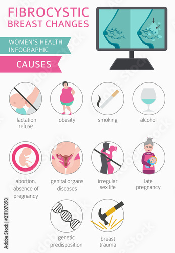 Fibrocystic breast changes disease, medical infographic. Diagnostics, symptoms, treatment. Women`s health icon set