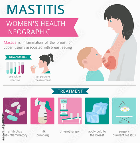 Mastitis, breastfeed, medical infographic. Diagnostics, symptoms, treatment. Women`s health icon set