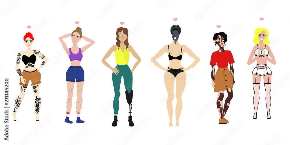 Body positive women set. young female characters with vitiligo skin disease, leg prosthesis handicap, tattoo all the body, cellulitis and excessive hair on legs, armpit. Vector flat illustration