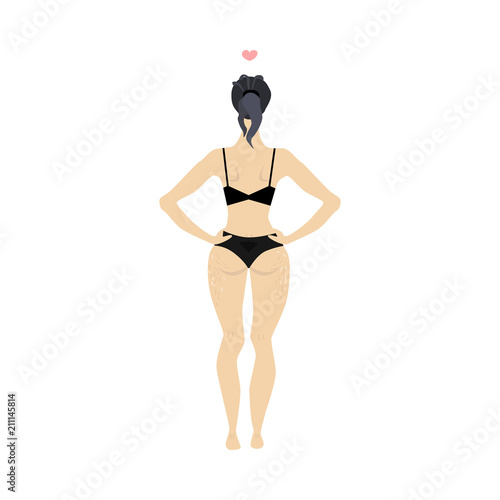 Young woman with cellulitis in sexy underwear bikini lingerie standing with arms on weist back view. Body positive concept. Vector flat isolated illustration