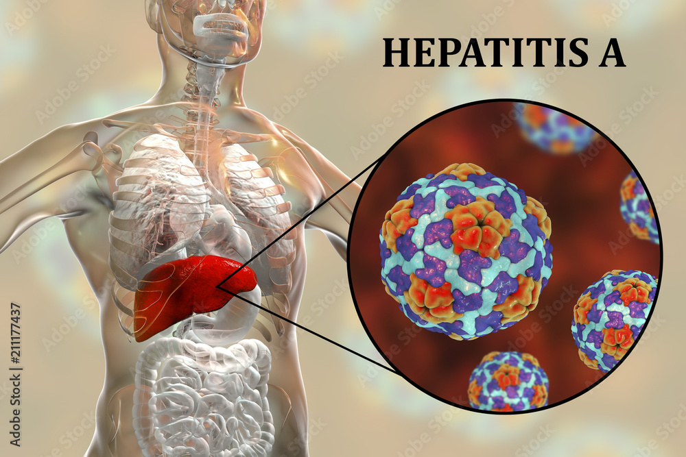 Hepatitis A Viruses HAV In Liver D Illustration HAV Infect Humans Through Contaminated Water