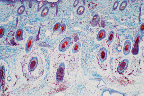 Cross section human skin tissue under microscope view photo