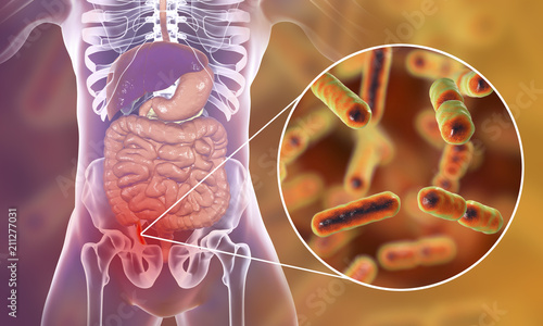 Acute appendicitis caused by bacteria Bacteroides, Gram-negative anaerobic rod-shaped bacteria, one of the common causative agents of appendicitis, 3D illustration photo