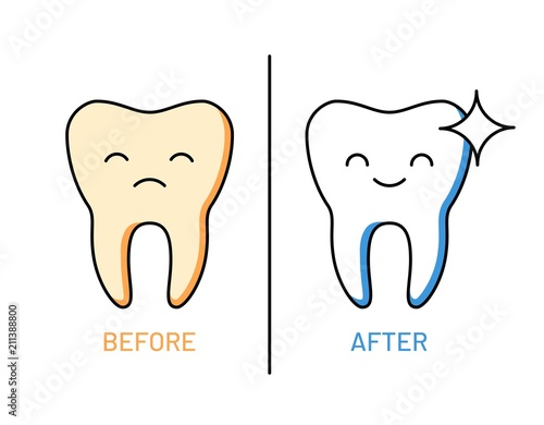 Professional teeth cleaning outline illustration. Whitening toothpaste advertising. Comic dental characters before and after cleaning. Modern stomatology assistance and oral hygiene vector concept