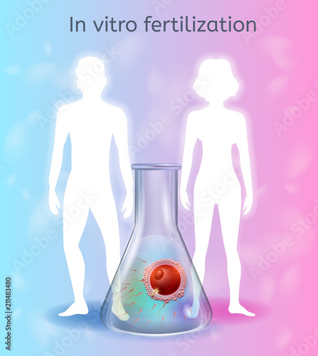In Vitro Fertilization Realistic Vector Concept