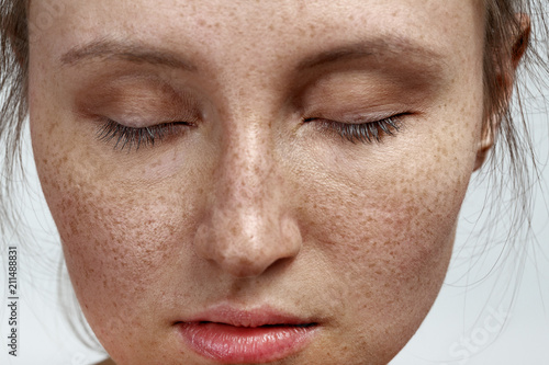 woman with freckles photo