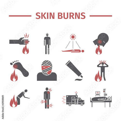 Skinl Burns kine icons. Treatment. Vector illustrations