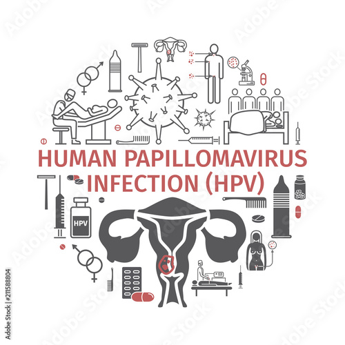 Human papillomavirus infection HPV. Vector infographics.