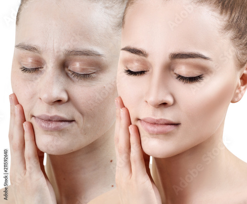 Fotografi Portrait of woman before and after skin rejuvenation
