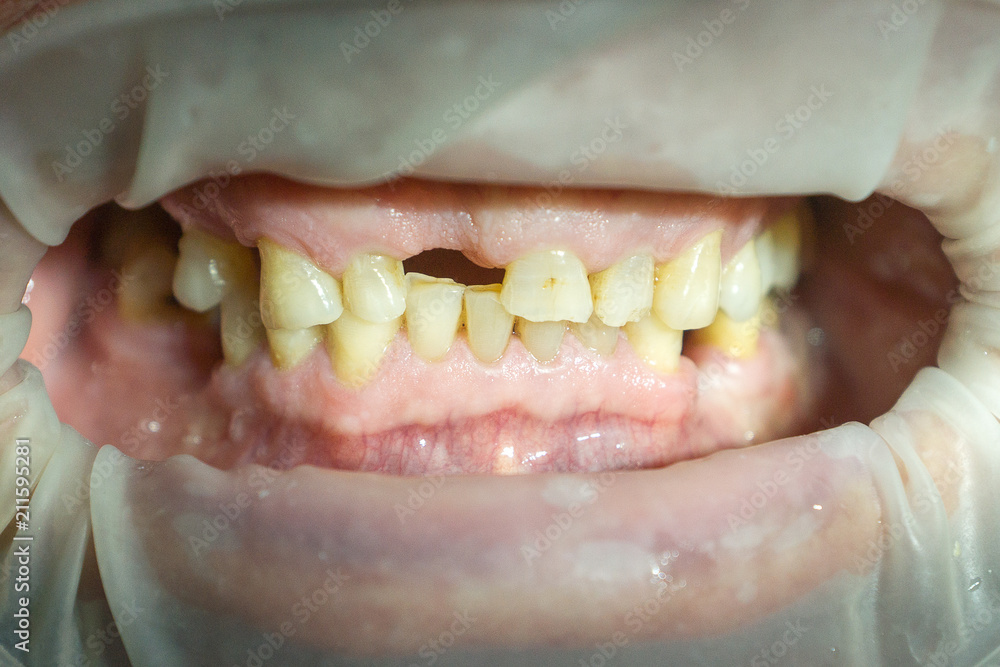 Fototapeta premium work of the stosatologist