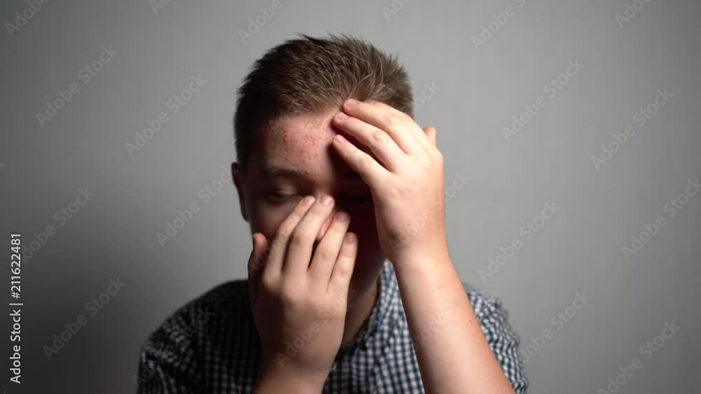 Portrait Young Man with emotions and feelings, looking at camera. Sad teenager boy with skin Dermatitis
