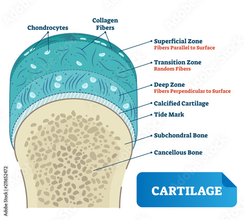 Cartilage vector illustration. Scheme of chondrocytes, collagen fibers, calcified, subchondral and cancellous bone. Diagram of superficial, transition zone.