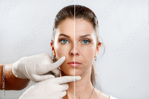 Comparison. Portrait of a young woman, comparing youth and old age, the effect of applying Botox injections. Face plasty, injections, stilting, rejuvenation.
