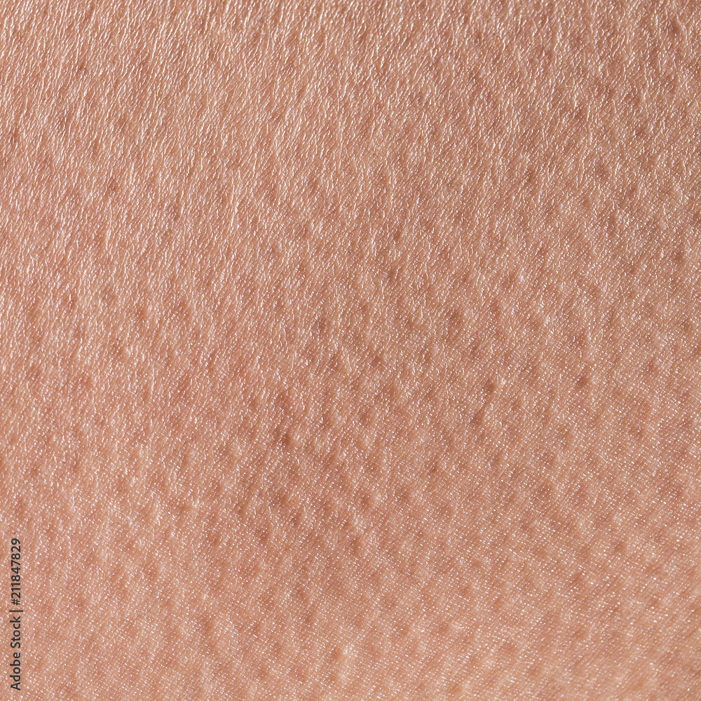 background of a pink skin texture of a man covered with pores and goosebumps background of a pink skin texture of a man covered with pores and goosebumps