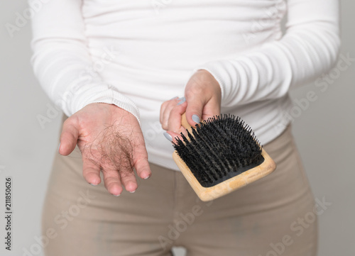 Female losing hair on hairbrush in hand. Hair loss problem, postpartum period, menstrual disorder, stress. Many hair fall after combing in hairbrush photo