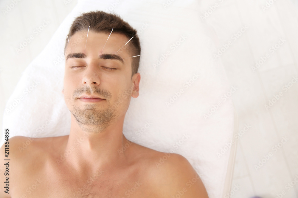 Young man undergoing acupuncture treatment in salon - obrazy, fototapety, plakaty 